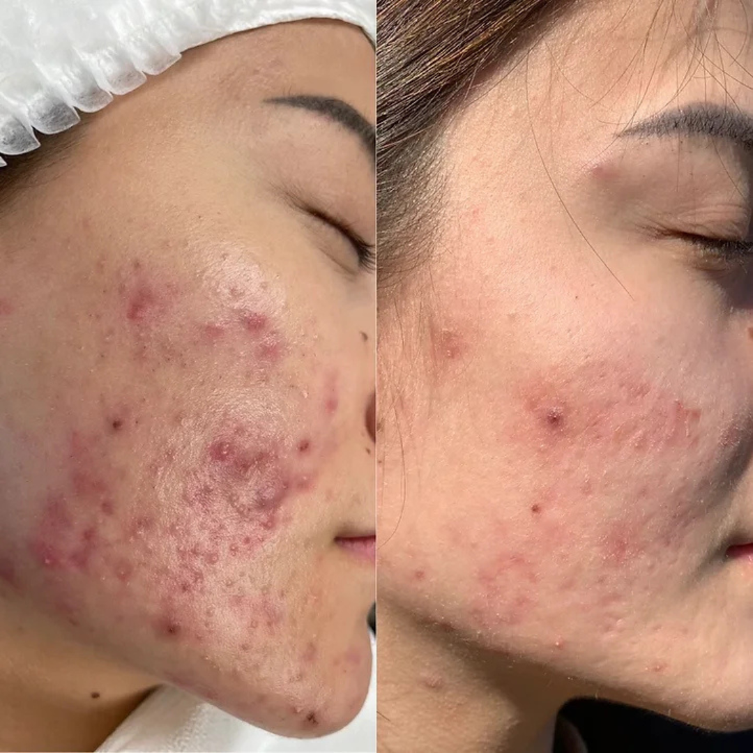 Arencia Vitamin C Cream | Removes Dark Spots & Pigmentation | Deep Hydration & Skin Brightening