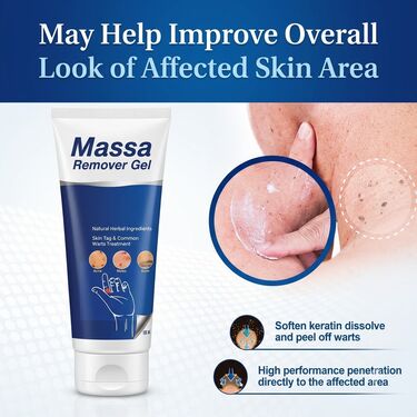 Massa Remover Gel | Buy 1 Get 1 Free