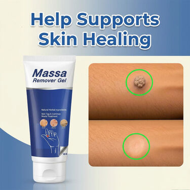 Massa Remover Gel | Buy 1 Get 1 Free