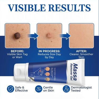 Massa Remover Gel | Buy 1 Get 1 Free