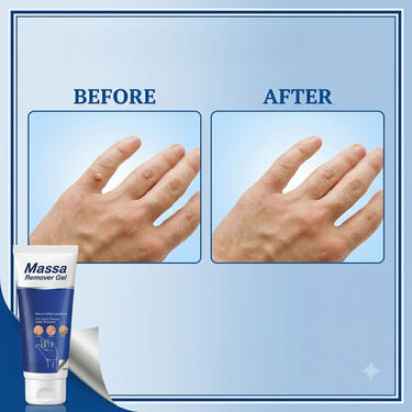 Massa Remover Gel | Buy 1 Get 1 Free