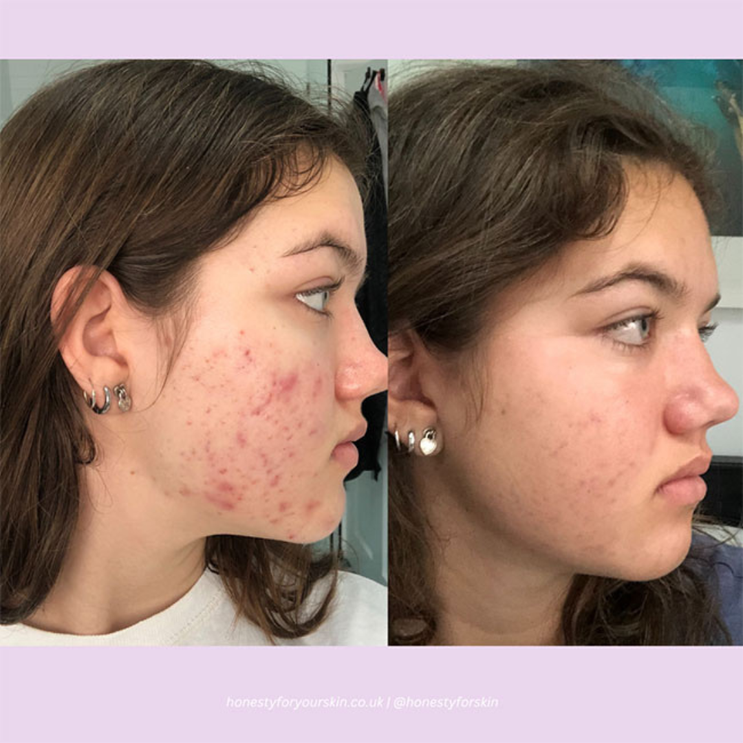 Arencia Vitamin C Cream | Removes Dark Spots & Pigmentation | Deep Hydration & Skin Brightening