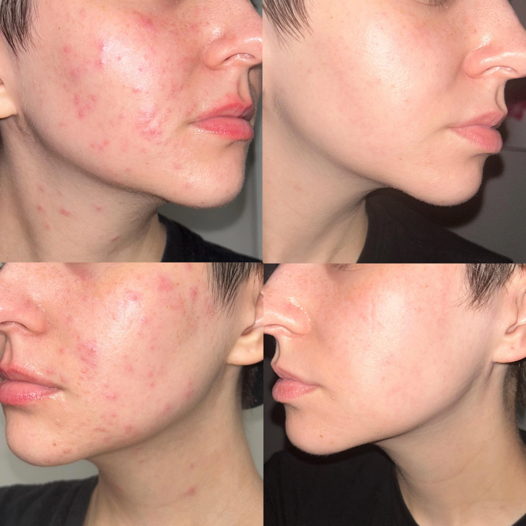 Arencia Vitamin C Cream | Removes Dark Spots & Pigmentation | Deep Hydration & Skin Brightening