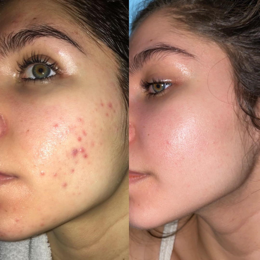 Arencia Vitamin C Cream | Removes Dark Spots & Pigmentation | Deep Hydration & Skin Brightening