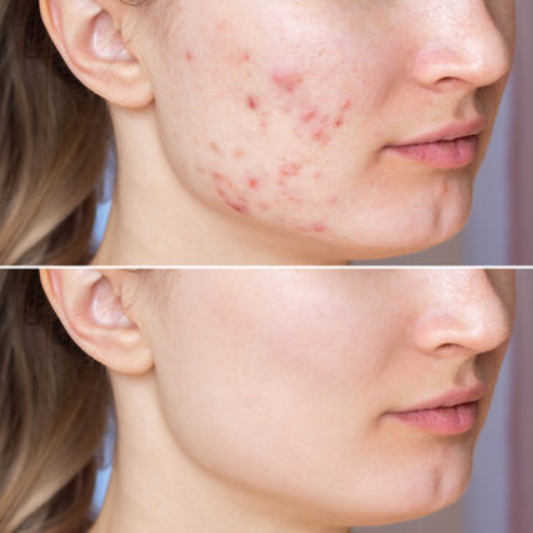 Arencia Vitamin C Cream | Removes Dark Spots & Pigmentation | Deep Hydration & Skin Brightening