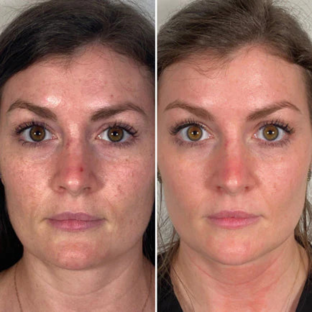 Arencia Vitamin C Cream | Removes Dark Spots & Pigmentation | Deep Hydration & Skin Brightening