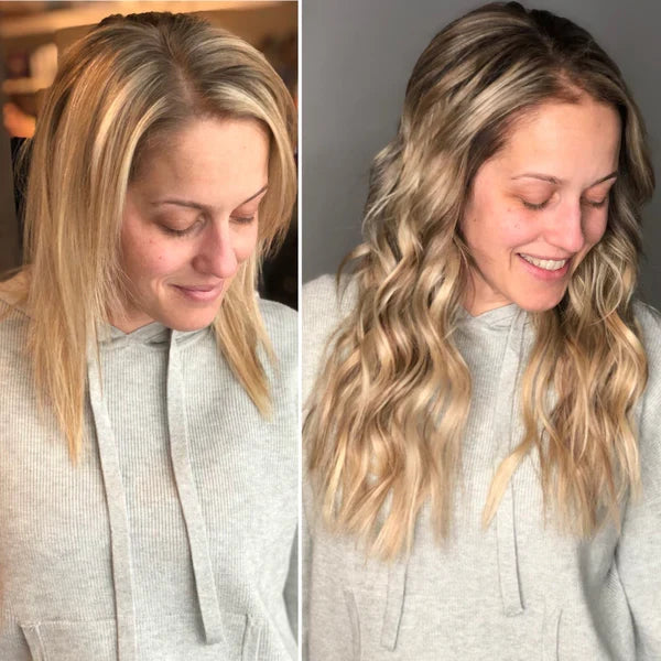 Proskire Hair Growth Serum – Reduces Hair Fall, Boosts Hair Density [Buy 1 Get 1 Free]