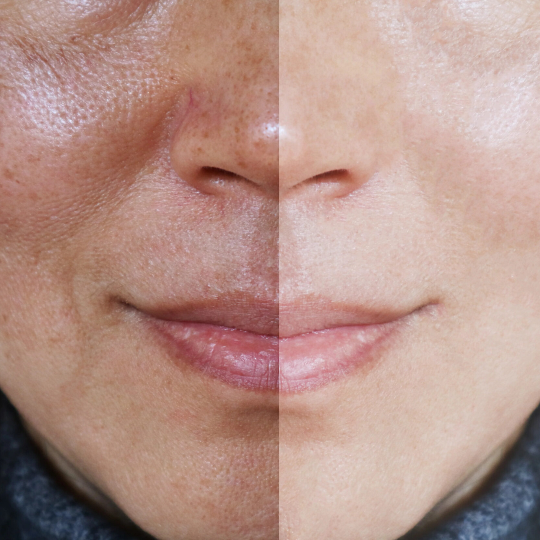 Arencia Vitamin C Cream | Removes Dark Spots & Pigmentation | Deep Hydration & Skin Brightening