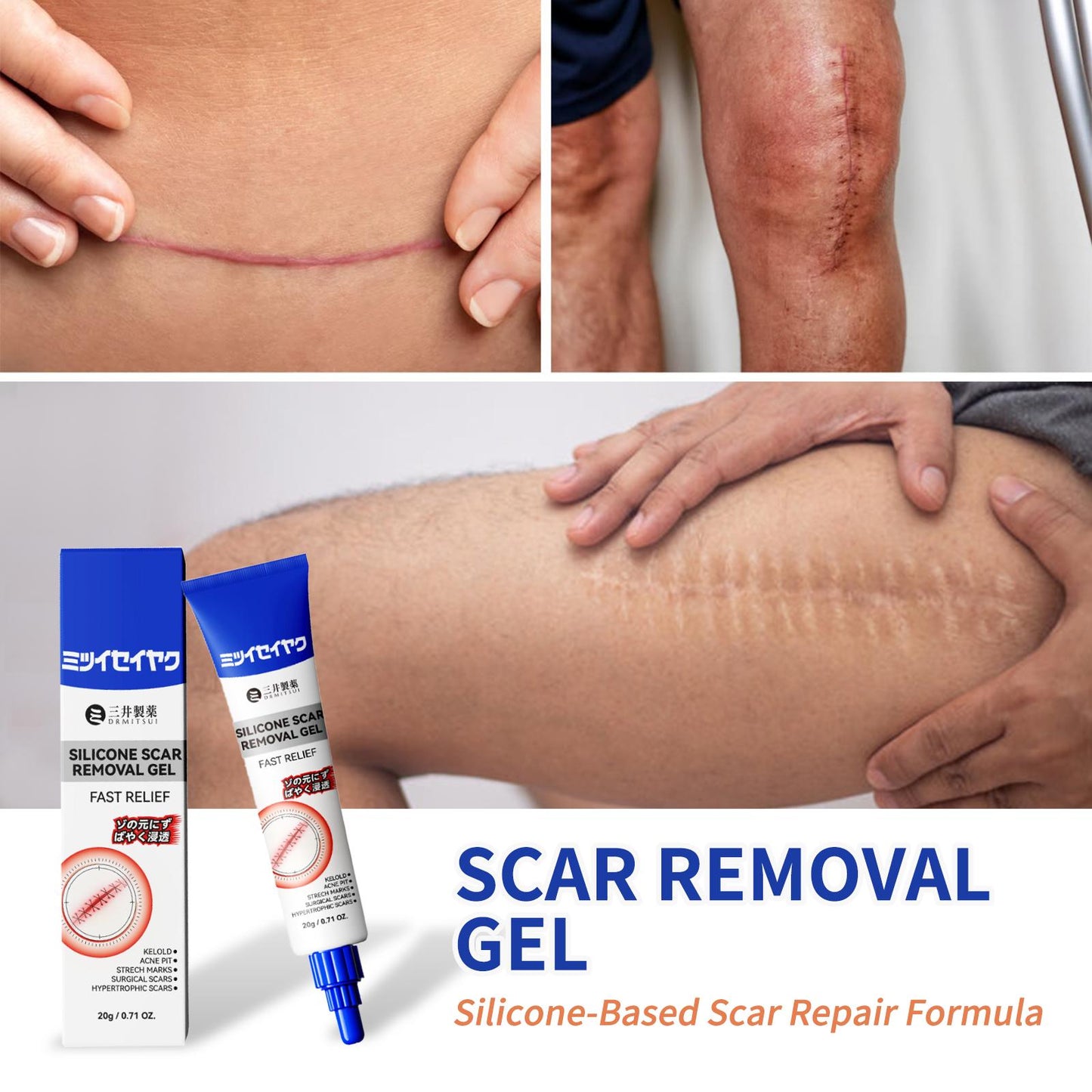 Silicone Scar Cream for Old and New Scars | Buy 1 Get 1 Free