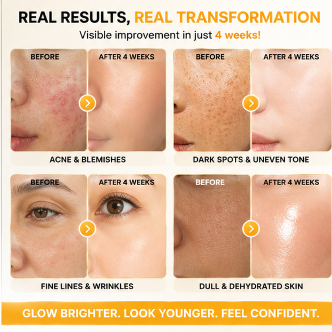 Arencia Vitamin C Cream | Removes Dark Spots & Pigmentation | Deep Hydration & Skin Brightening