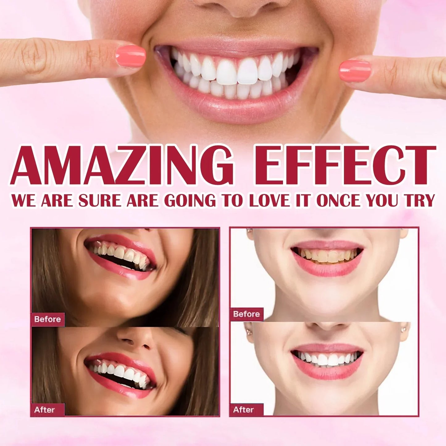 Yayashi SP4 Oral Care probiotic - Teeth Whitening Toothpaste | 100% Orignal