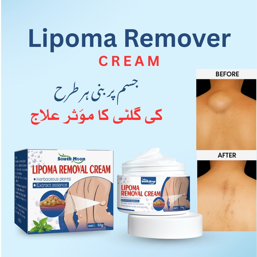 South Moon Lipoma Removal Cream – Herbal Extract