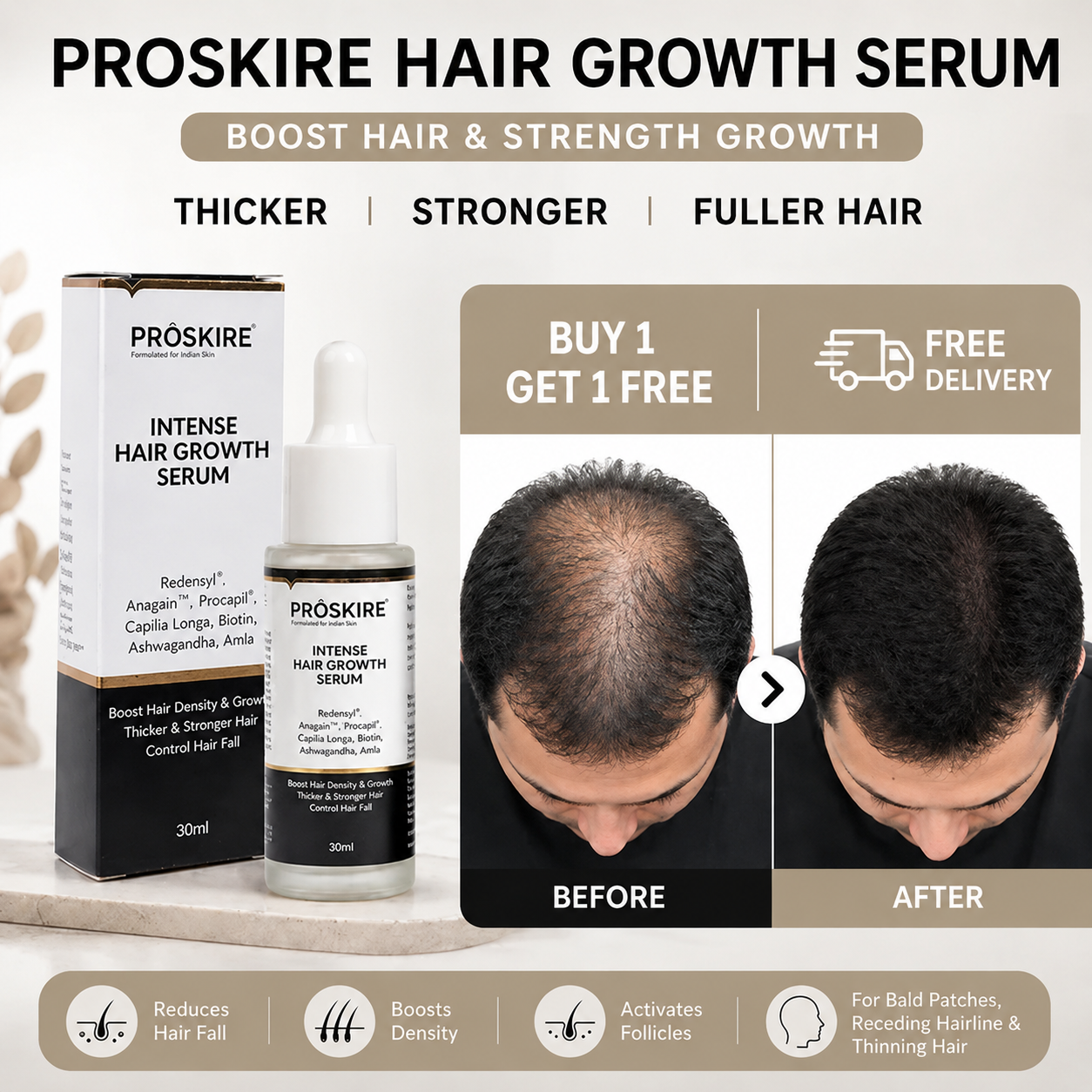 Proskire Hair Growth Serum – Reduces Hair Fall, Boosts Hair Density [Buy 1 Get 1 Free]