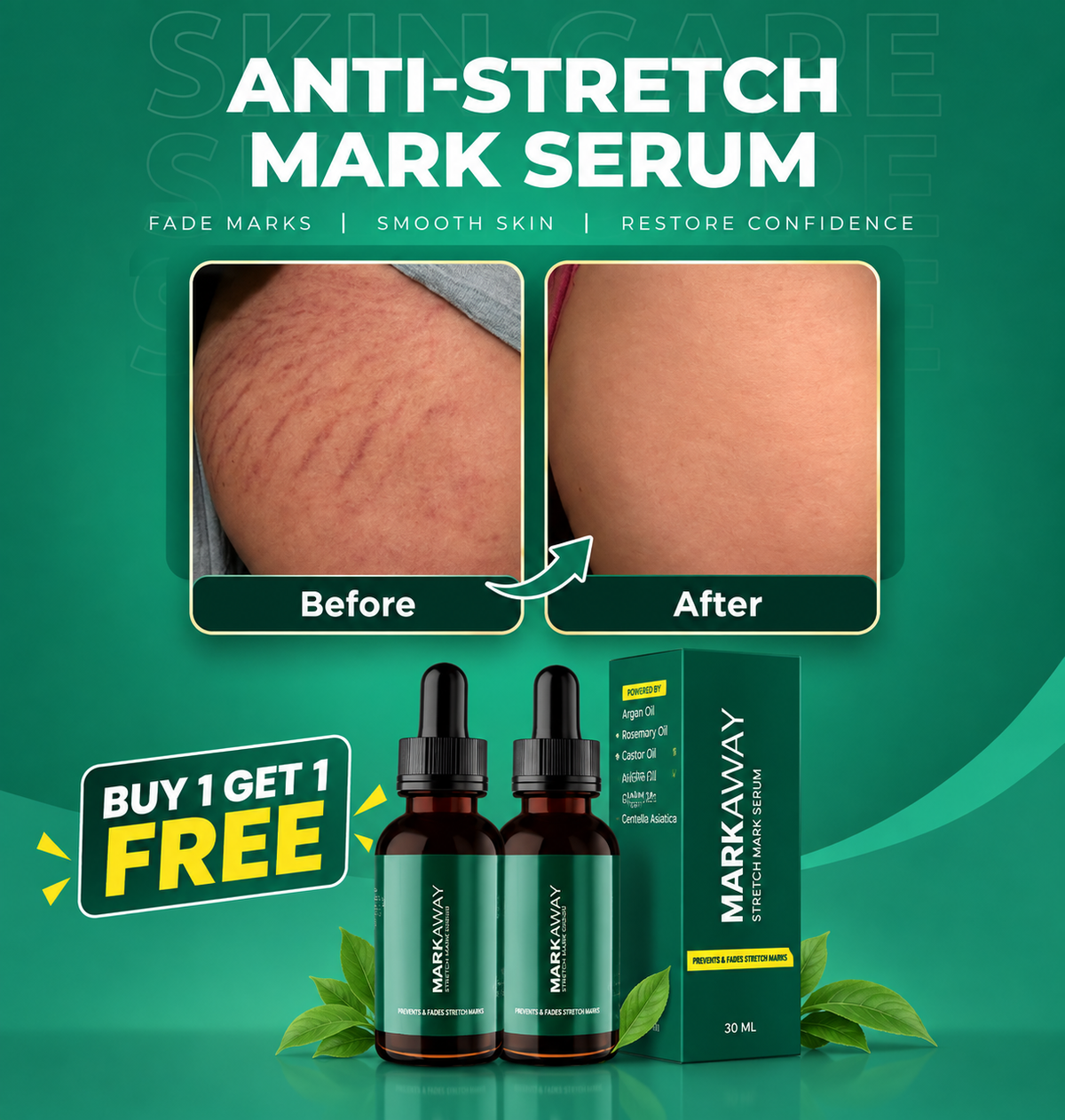 Markaway Stretch Mark Serum – Hydrating Skin Care | Buy 1 Get 1 Free