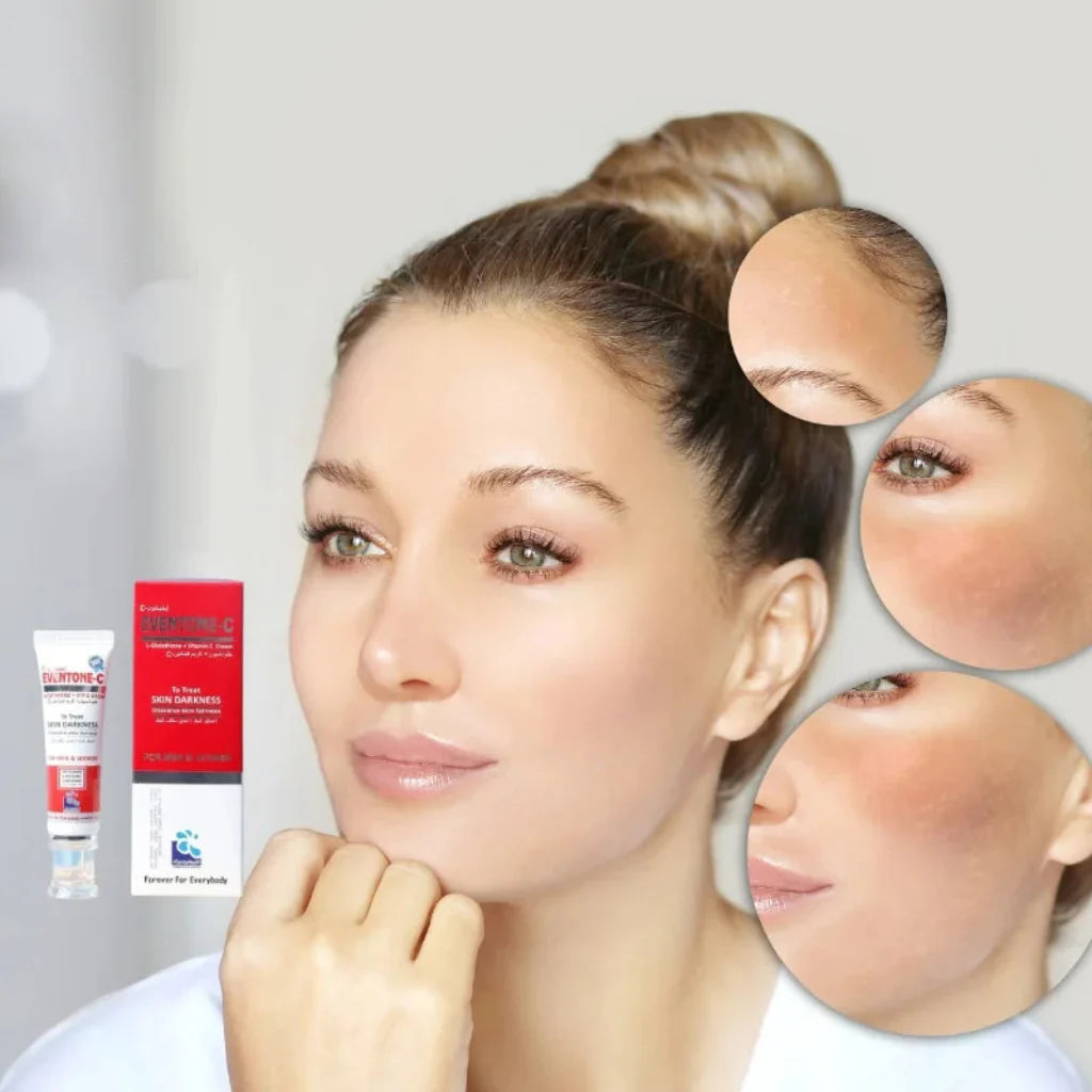 Eventone-C Cream - Skin Whitening & Brightening Formula (Both for Men & Women)
