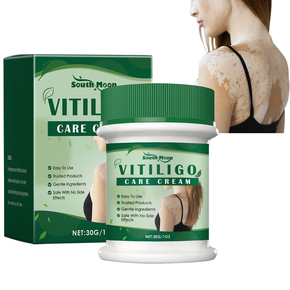 Vitiligo Herbal Aloe Vera & Mint Care Cream [ Buy 1 Get 1 Free ]