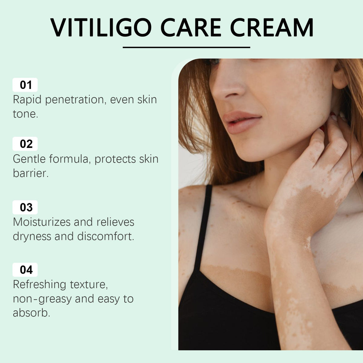 Vitiligo Herbal Aloe Vera & Mint Care Cream [ Buy 1 Get 1 Free ]