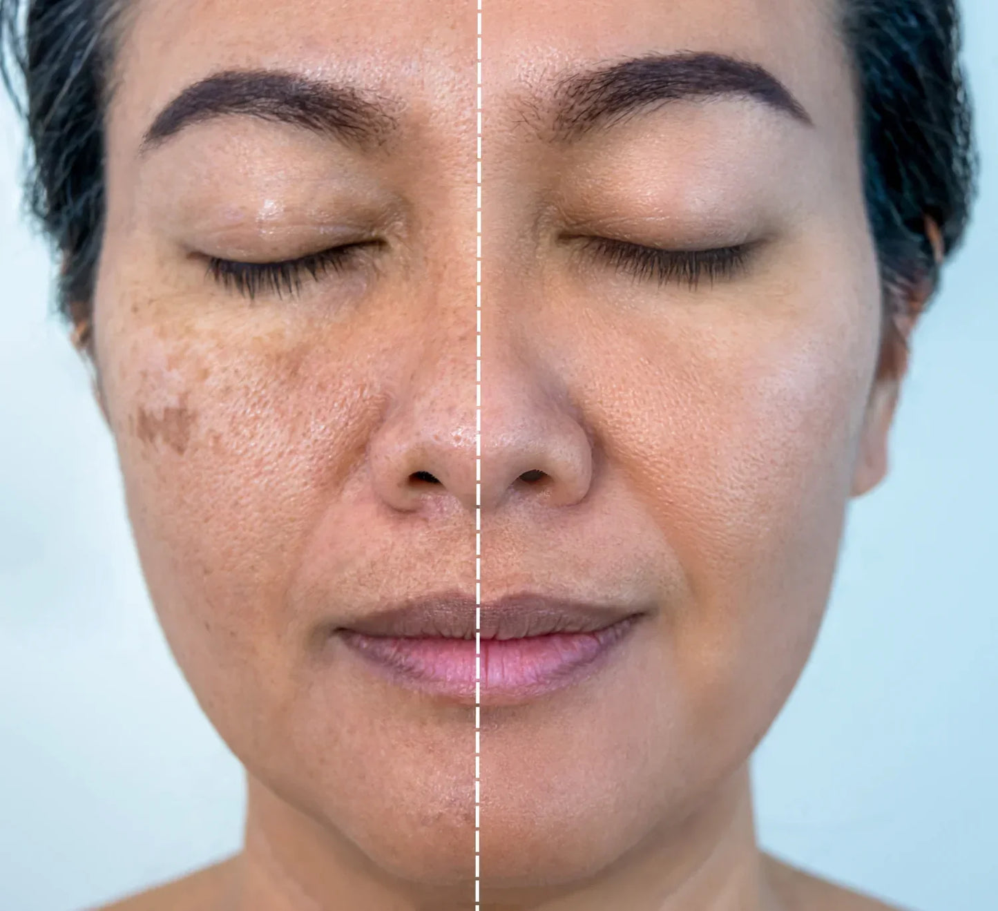 Arencia Vitamin C Cream | Removes Dark Spots & Pigmentation | Deep Hydration & Skin Brightening