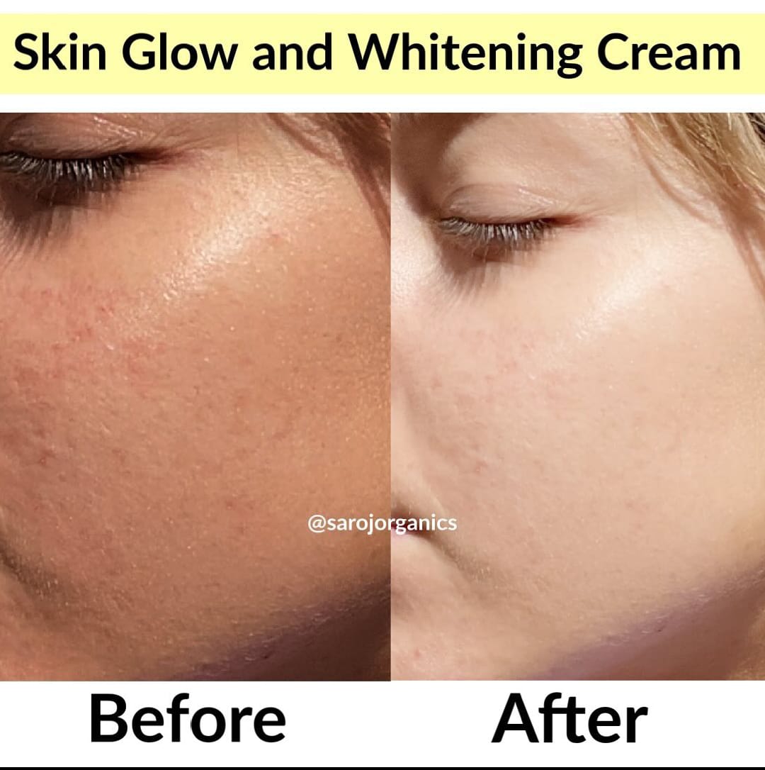 GLOW & WHITE KOREAN WHITENING GOLD CREAM (500gm)