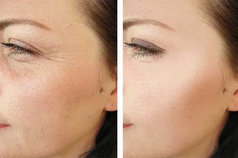 Celimax Retinal Shot Tightening Booster | Buy 1 Get 1 Free