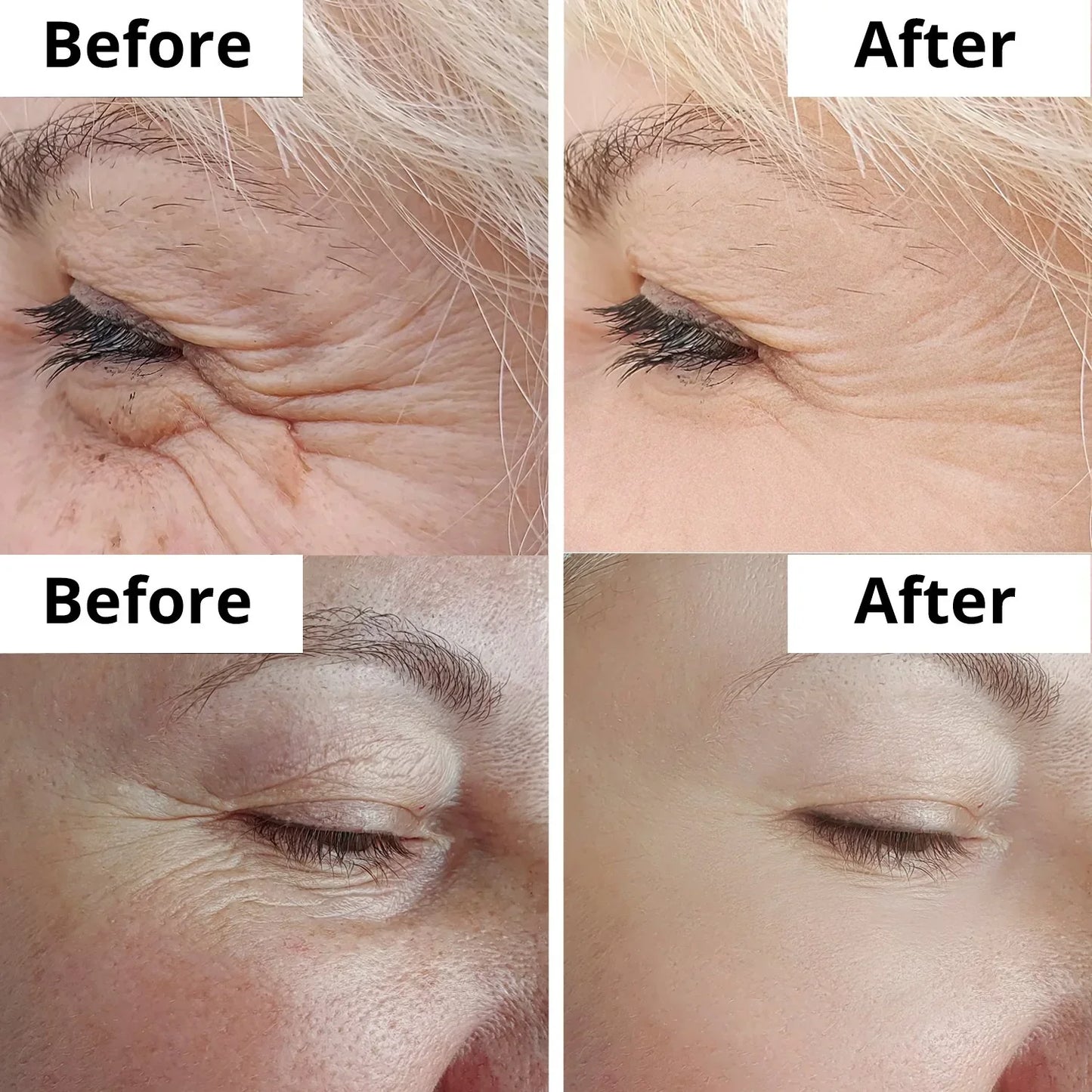 Arencia Vitamin C Cream | Removes Dark Spots & Pigmentation | Deep Hydration & Skin Brightening