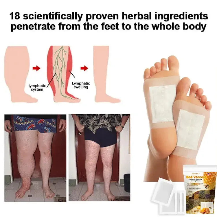 Bee Venom Detox Foot Patches 10 Pcs | Natural Body Cleansing Pads