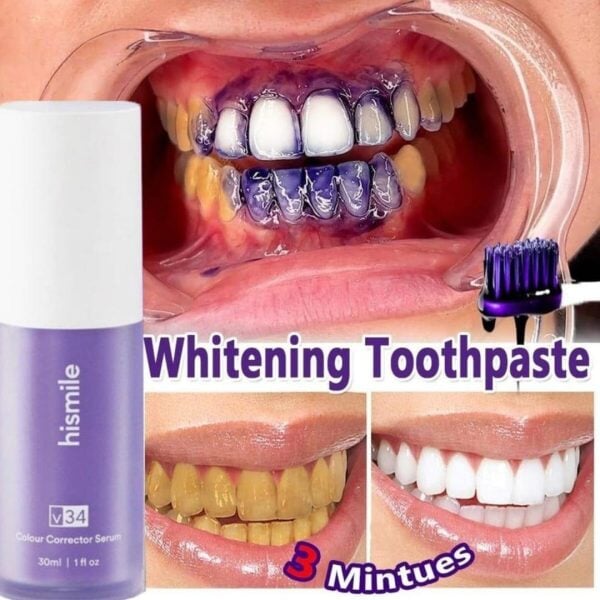 𝗛𝗶𝗦𝗺𝗶𝗹𝗲 𝗩𝟯𝟰 𝗧𝗲𝗲𝘁𝗵 𝗪𝗵𝗶𝘁𝗲𝗻𝗶𝗻𝗴 𝗦𝗲𝗿𝘂𝗺 Teeth Whitening Serum Pak deal 