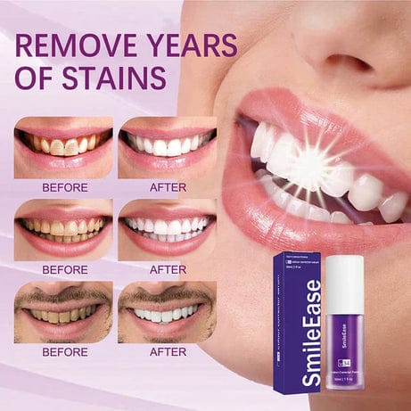 𝗛𝗶𝗦𝗺𝗶𝗹𝗲 𝗩𝟯𝟰 𝗧𝗲𝗲𝘁𝗵 𝗪𝗵𝗶𝘁𝗲𝗻𝗶𝗻𝗴 𝗦𝗲𝗿𝘂𝗺 Teeth Whitening Serum Pak deal 
